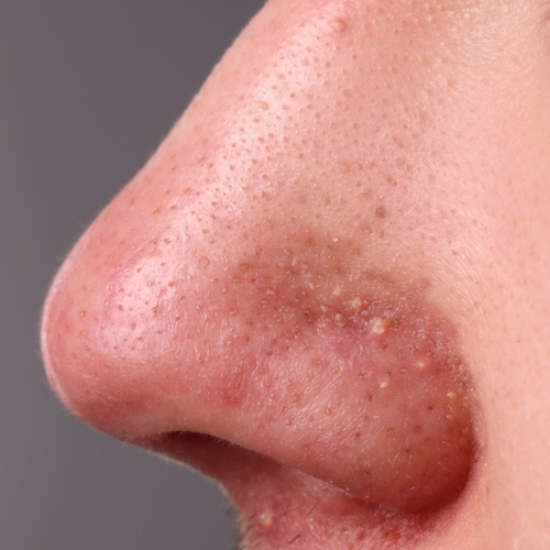 Vorteile des Biovana Produkts