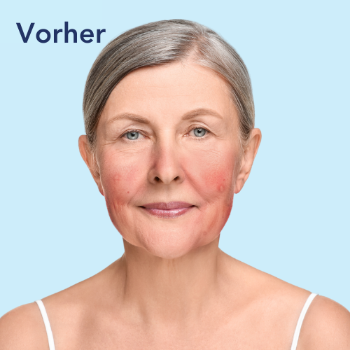 Vorher Vergleichsbild