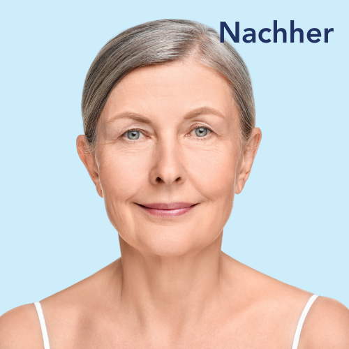 Nachher Vergleichsbild